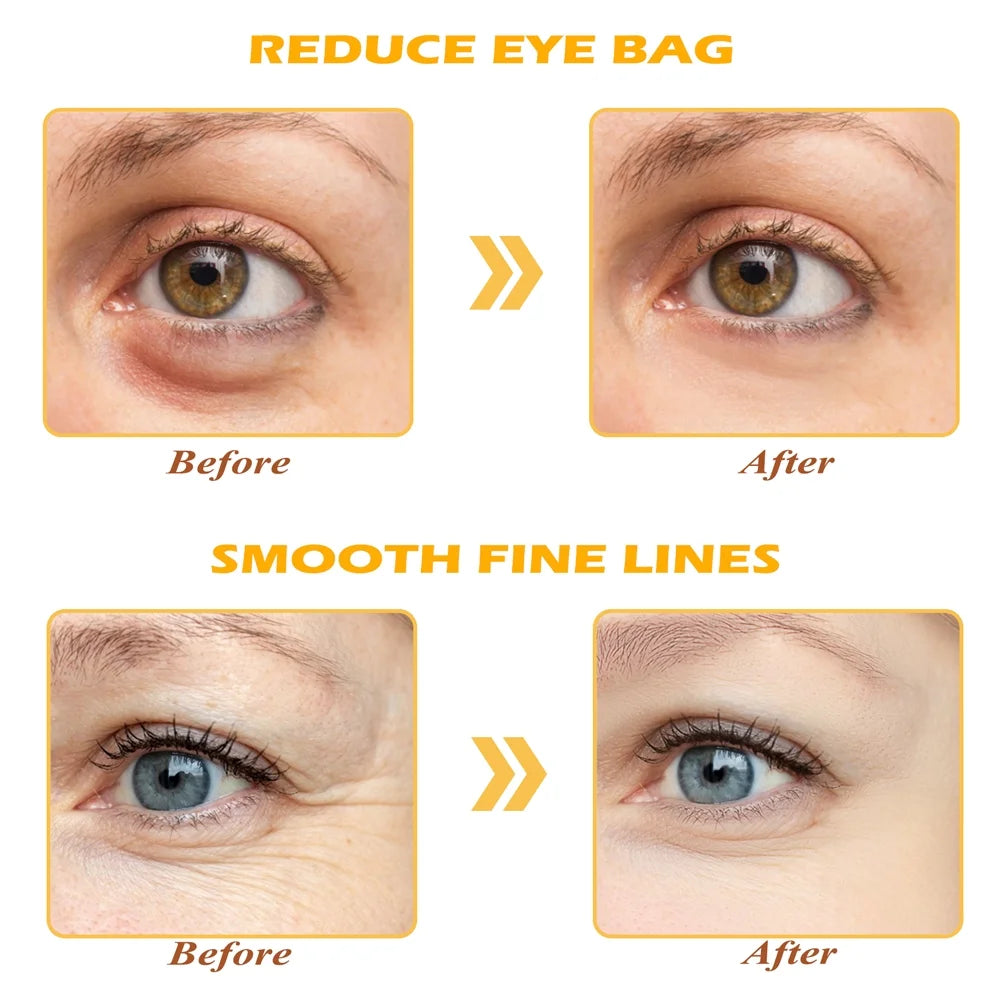 Golden Eye Mask, 30 Pairs under Eye Masks for Dark Circles and Puffiness, under Eye Patches for Puffy Eyes and Eye Bags, Gel Eye Mask Eye Pads for Face Skin Care