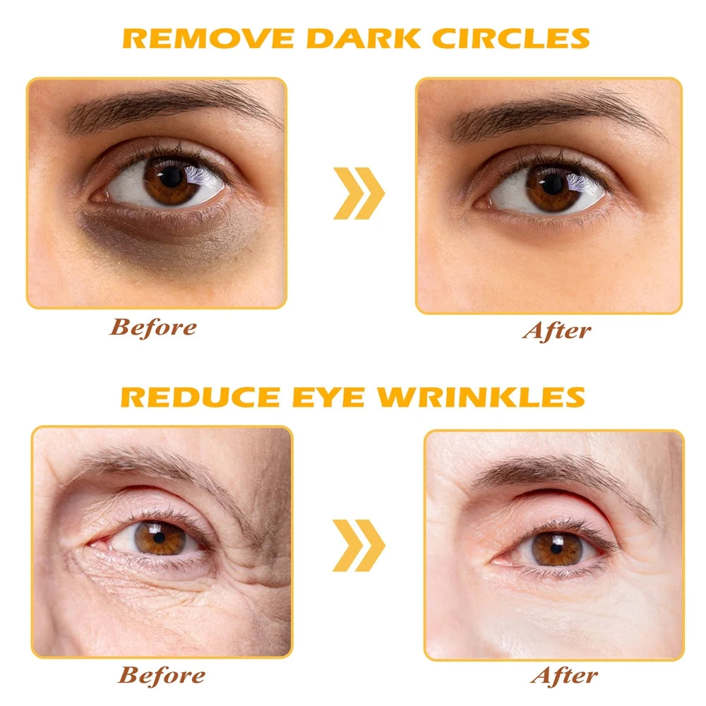 Golden Eye Mask, 30 Pairs under Eye Masks for Dark Circles and Puffiness, under Eye Patches for Puffy Eyes and Eye Bags, Gel Eye Mask Eye Pads for Face Skin Care